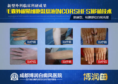 中国核工业416医院专家组莅临我院参观交流,强化科研合作,提升专家型医院诊疗实力 中国核工业416医院专家组莅临我院参观交流,强化科研合作,提升专家型医院诊疗实力