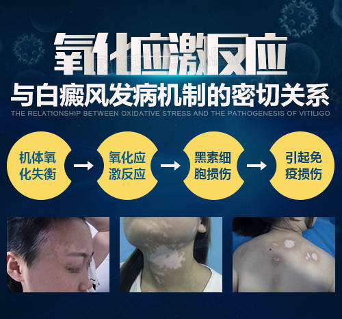 11.18北大教授葛蒙梁亲临会诊 11.18北大教授葛蒙梁亲临会诊
