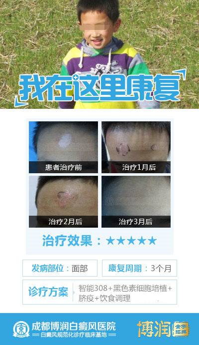 寒假去哪儿?给孩子一份祛白强化治疗,比起补课游玩更紧要! /uploads/allimg/20180117/68611516169712.jpg